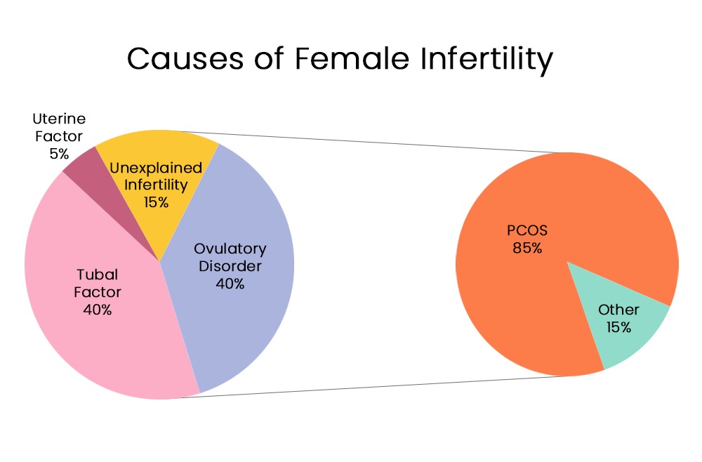 causes of female infertility diagram