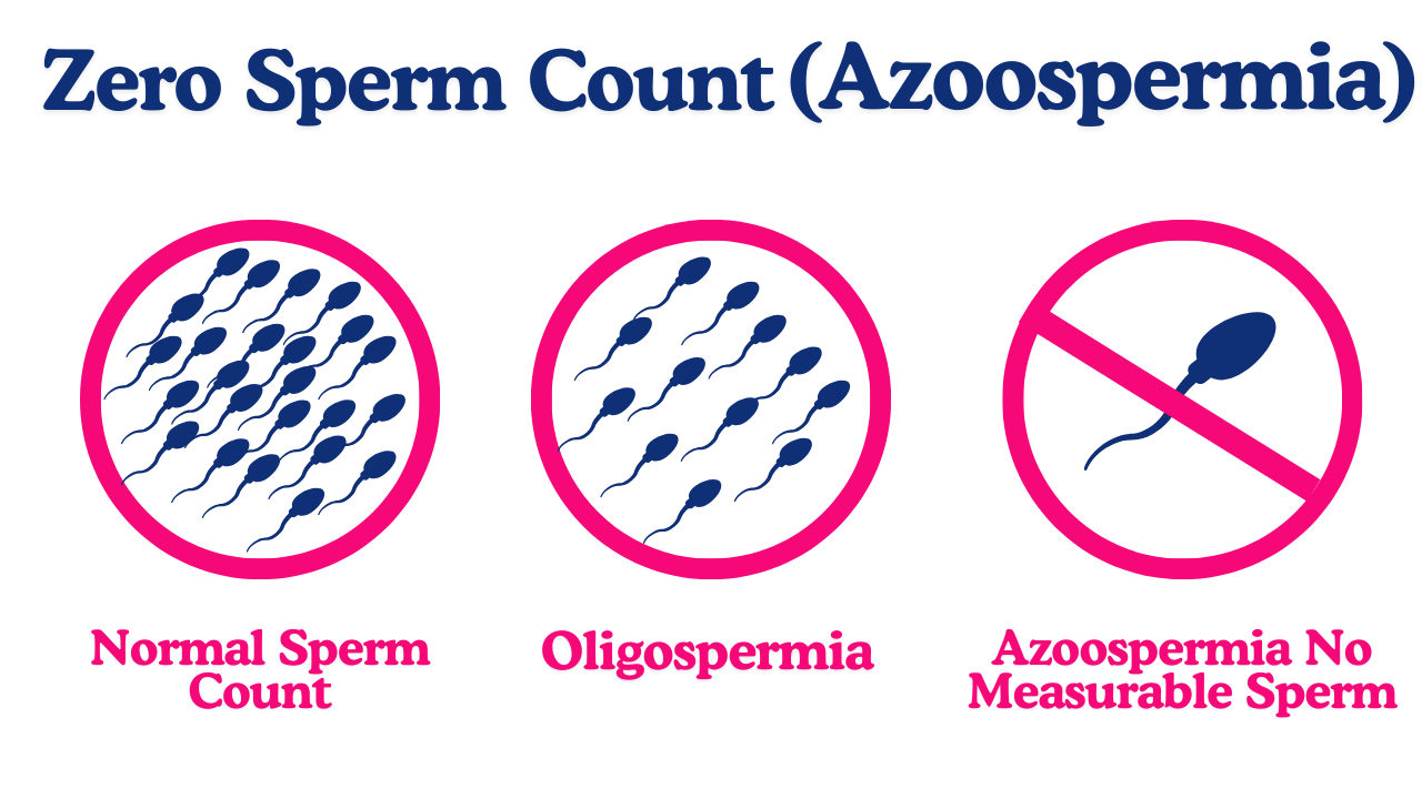 Zero Sperm Count? Understanding Azoospermia Causes & Solutions