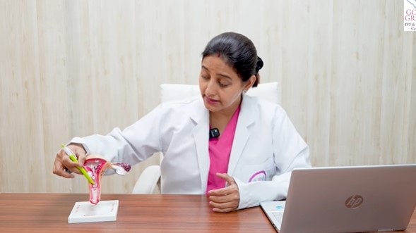 IUI Treatment Cost in Delhi